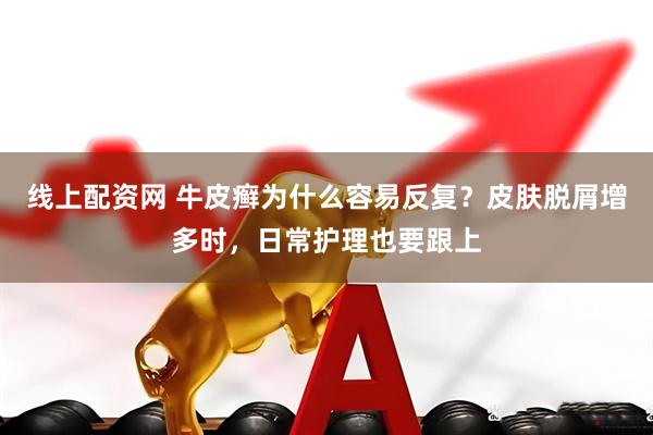 线上配资网 牛皮癣为什么容易反复？皮肤脱屑增多时，日常护理也要跟上